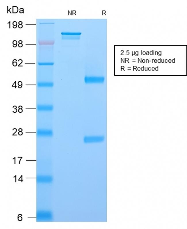 NGF-Receptor (p75)/CD271 Antibody in SDS-PAGE (SDS-PAGE)