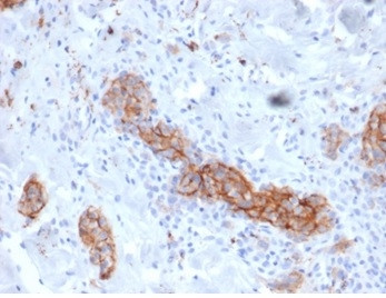 NGF-Receptor (p75)/CD271 (Soft Tissue Tumor Marker) Antibody in Immunohistochemistry (Paraffin) (IHC (P))