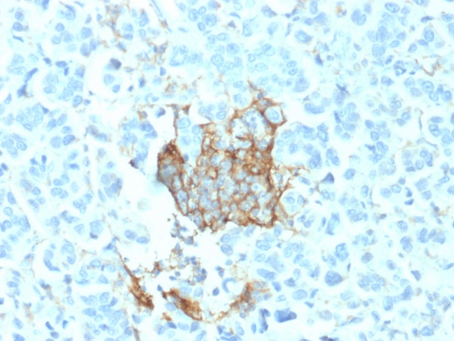 NGF-Receptor (p75)/CD271 Antibody in Immunohistochemistry (Paraffin) (IHC (P))