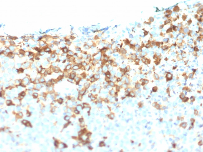 NGF-Receptor (p75)/CD271 Antibody in Immunohistochemistry (Paraffin) (IHC (P))