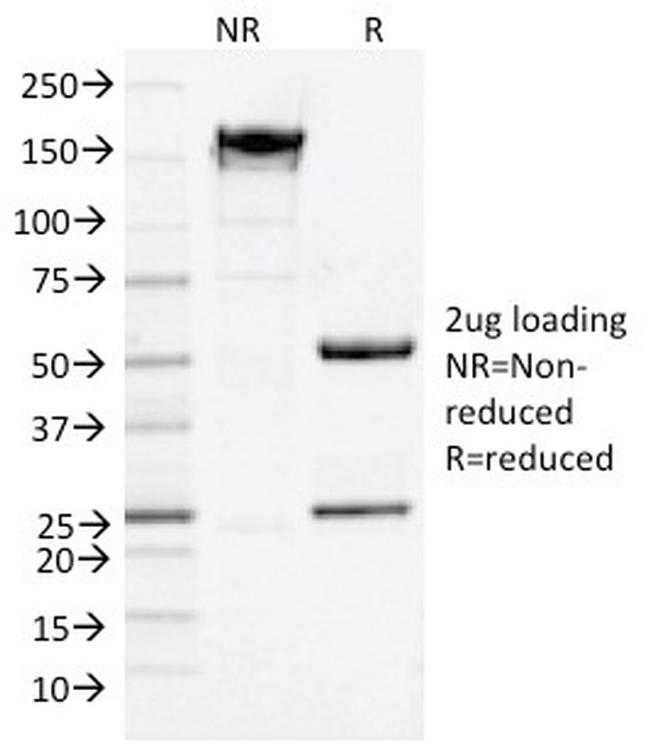 NGF-Receptor (p75)/CD271 Antibody in SDS-PAGE (SDS-PAGE)