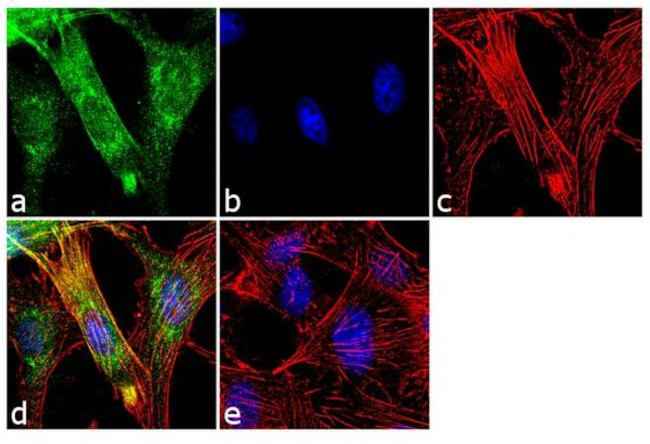 Doublecortin Antibody in Immunocytochemistry (ICC/IF)