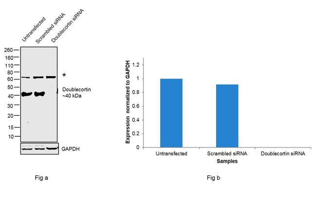 Doublecortin Antibody in Western Blot (WB)