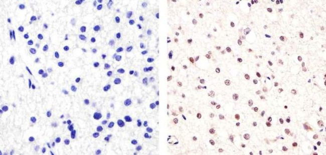 SOX2 Antibody in Immunohistochemistry (Paraffin) (IHC (P))