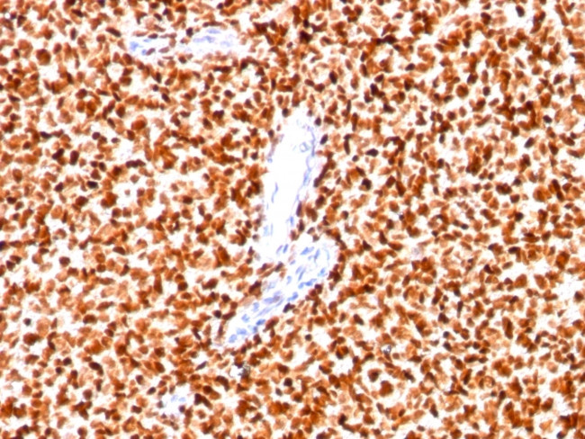 NKX2.2 (Neuroendocrine and Ewing'sarcoma Marker) Antibody in Immunohistochemistry (Paraffin) (IHC (P))