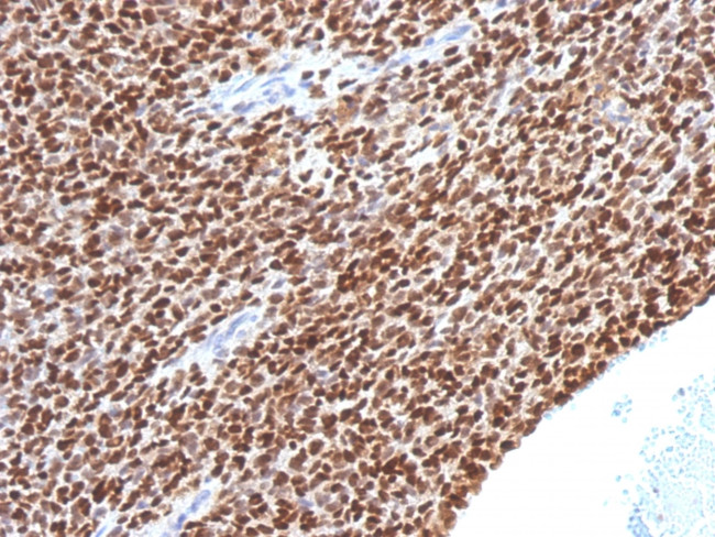 NKX2.2 (Neuroendocrine and Ewing's Sarcoma Marker) Antibody in Immunohistochemistry (Paraffin) (IHC (P))