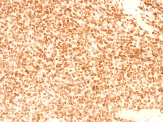 NKX2.2 (Neuroendocrine and Ewing's Sarcoma Marker) Antibody in Immunohistochemistry (Paraffin) (IHC (P))