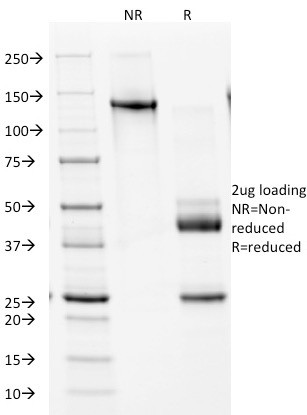 NKX2.2 (Neuroendocrine and Ewing's Sarcoma Marker) Antibody in SDS-PAGE (SDS-PAGE)