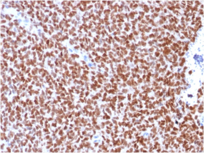 NKX2.2 Antibody in Immunohistochemistry (Paraffin) (IHC (P))