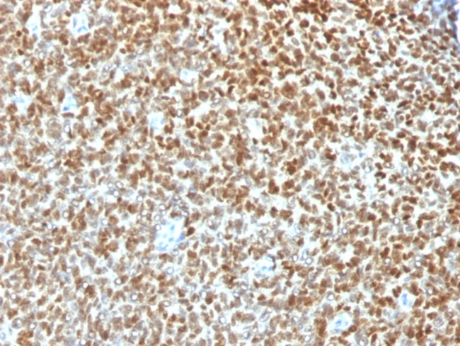 NKX2.2 (Neuroendocrine and Ewing's Sarcoma Marker) Antibody in Immunohistochemistry (Paraffin) (IHC (P))