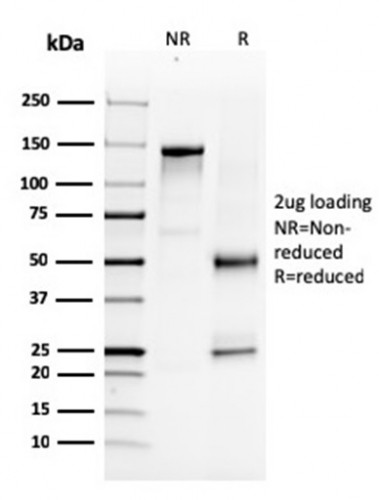 NKX3.1 (Metastatic Prostate Adenocarcinoma Marker) Antibody in SDS-PAGE (SDS-PAGE)