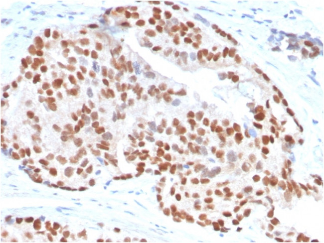 NKX3.1 (Metastatic Prostate Adenocarcinoma Marker) Antibody in Immunohistochemistry (Paraffin) (IHC (P))