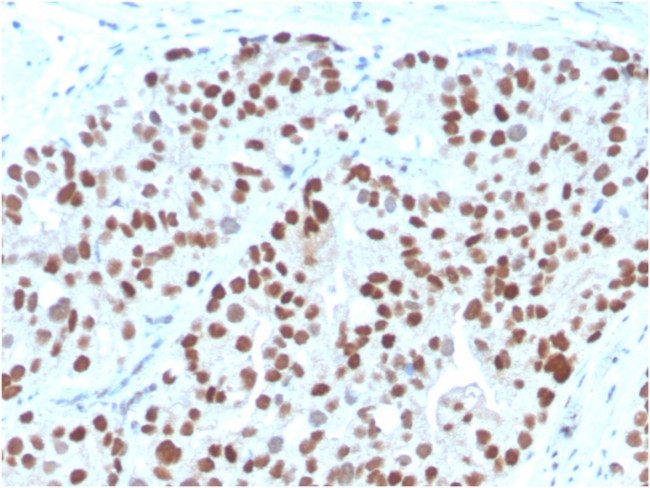 NKX3.1 (Metastatic Prostate Adenocarcinoma Marker) Antibody in Immunohistochemistry (Paraffin) (IHC (P))