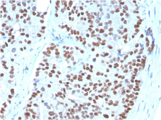 NKX3.1 (Metastatic Prostate Adenocarcinoma Marker) Antibody in Immunohistochemistry (Paraffin) (IHC (P))