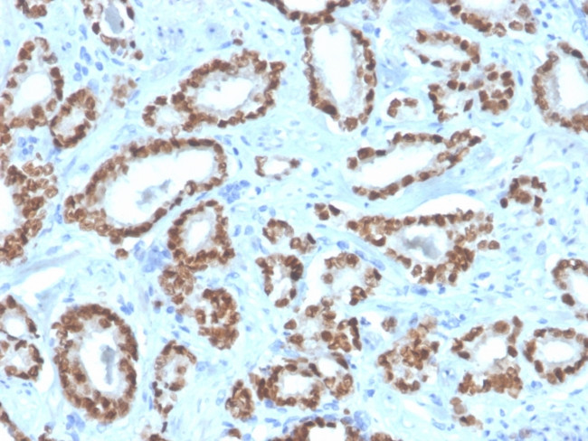 NKX3.1 Antibody in Immunohistochemistry (Paraffin) (IHC (P))