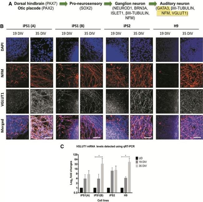 VGLUT1 Antibody in Immunocytochemistry (ICC/IF)