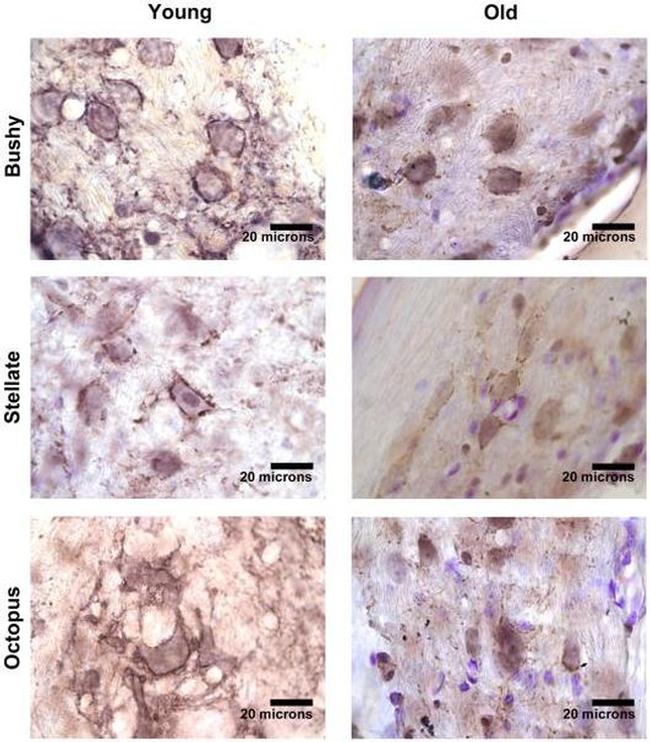 VGLUT1 Antibody in Immunohistochemistry - Free Floating (IHC (Free))