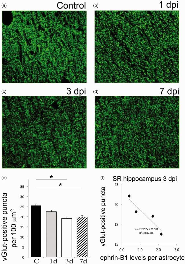 VGLUT1 Antibody in Immunohistochemistry (IHC)