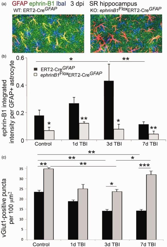 VGLUT1 Antibody in Immunohistochemistry (IHC)