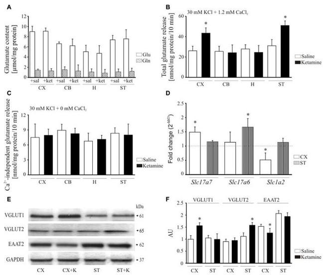 VGLUT1 Antibody in Western Blot (WB)