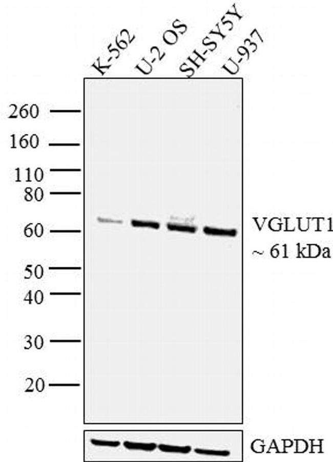 VGLUT1 Antibody in Western Blot (WB)