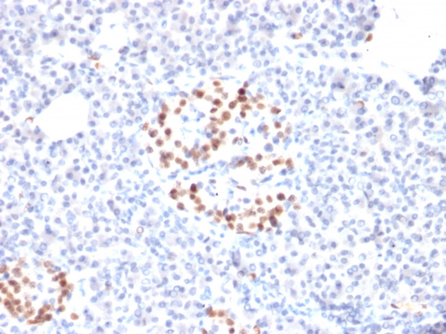 NKX6.1 (Marker for Pancreatic and Duodenal Neuroendocrine Tumors) Antibody in Immunohistochemistry (Paraffin) (IHC (P))