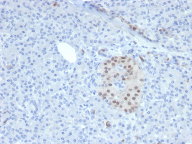 NKX6.1 (Marker for Pancreatic and Duodenal Neuroendocrine Tumors) Antibody in Immunohistochemistry (Paraffin) (IHC (P))