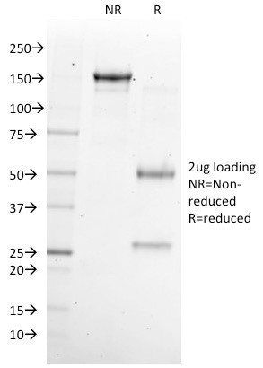 NKX6.1 (Marker for Pancreatic and Duodenal Neuroendocrine Tumors) Antibody in SDS-PAGE (SDS-PAGE)