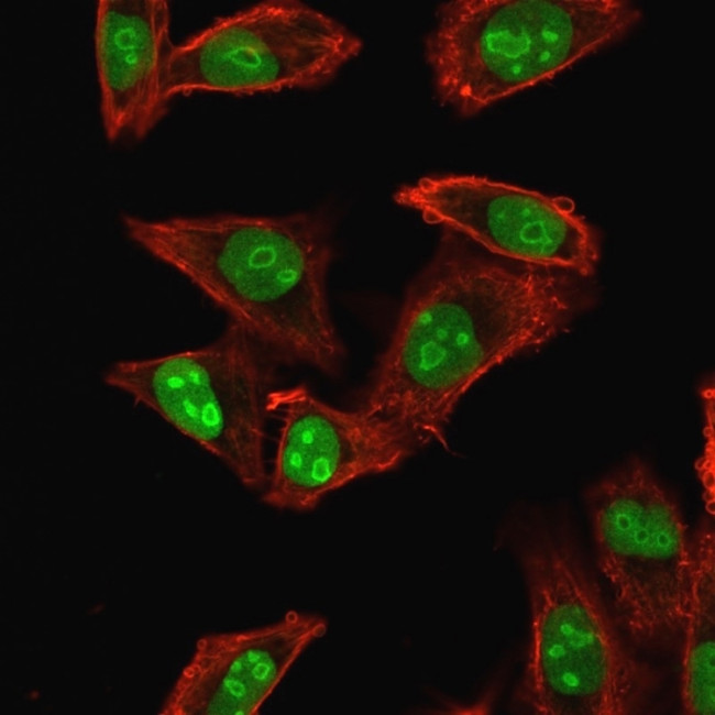 Nucleophosmin Antibody in Immunocytochemistry (ICC/IF)