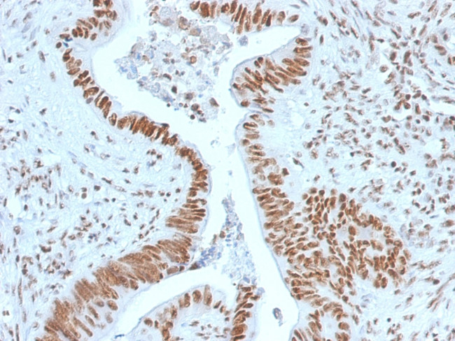 Nucleophosmin Antibody in Immunohistochemistry (Paraffin) (IHC (P))