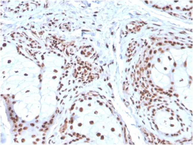 Nucleophosmin Antibody in Immunohistochemistry (Paraffin) (IHC (P))