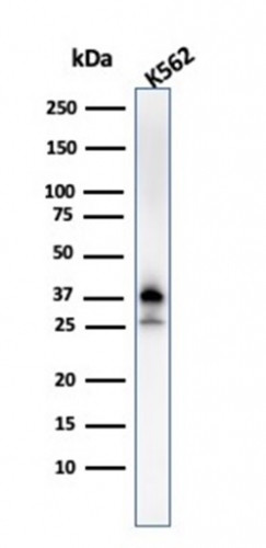 Nucleophosmin (Acute Myeloid Leukemia Marker) Antibody in Western Blot (WB)