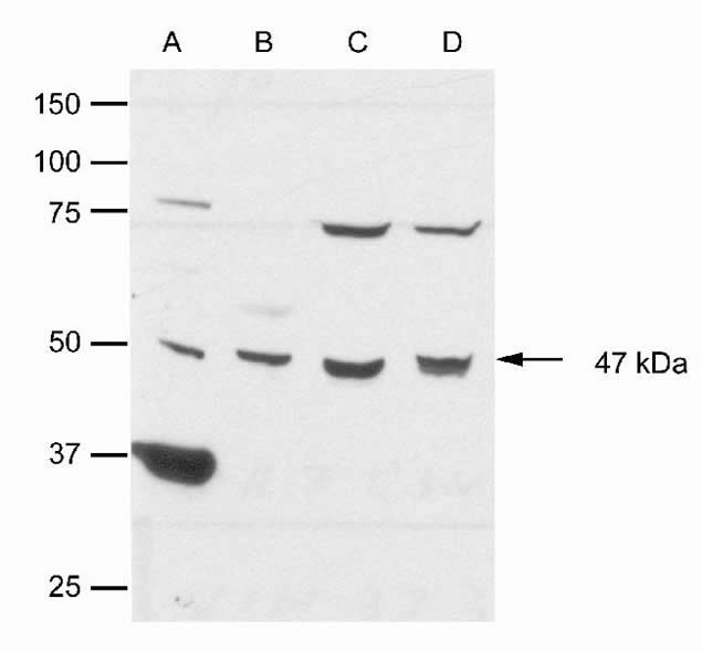 CK1 epsilon Antibody in Western Blot (WB)