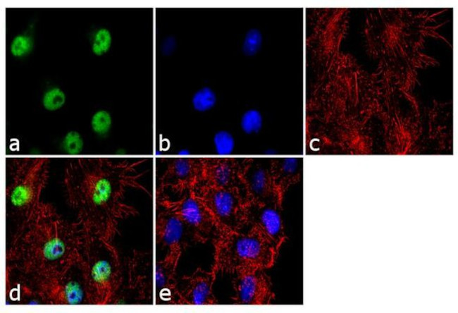 CK1 epsilon Antibody in Immunocytochemistry (ICC/IF)