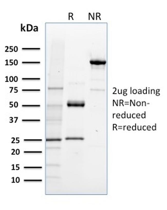 NRF1 Antibody in SDS-PAGE (SDS-PAGE)