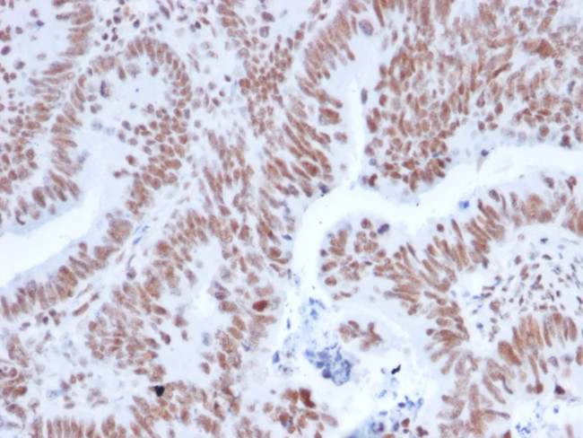 NRF1 Antibody in Immunohistochemistry (Paraffin) (IHC (P))