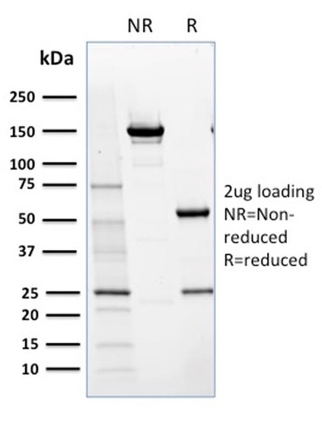 NRF1 Antibody in SDS-PAGE (SDS-PAGE)