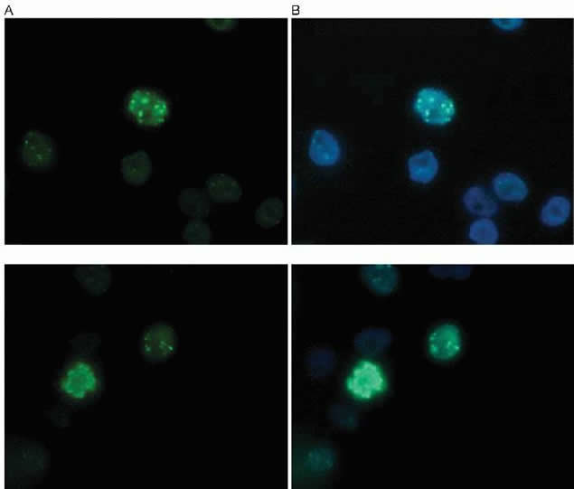 H3K27me3S28ph Antibody in Immunocytochemistry (ICC/IF)