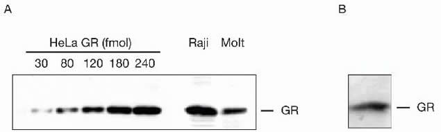 Glucocorticoid Receptor Antibody in Western Blot (WB)