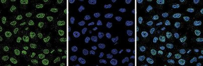 EZH2 Antibody in Immunocytochemistry (ICC/IF)