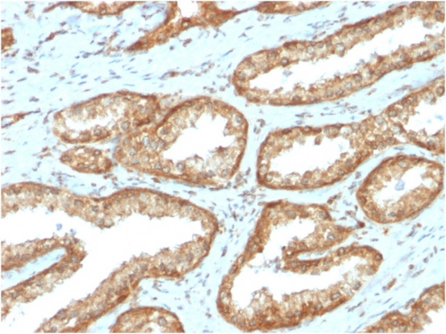 YBX1/Y-box Binding Protein 1/YB-1 Antibody in Immunohistochemistry (Paraffin) (IHC (P))