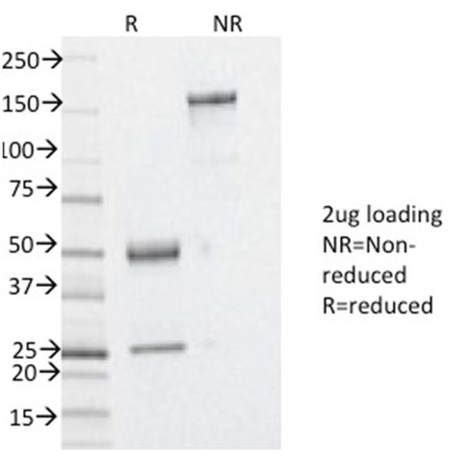 YBX1/Y-box Binding Protein 1/YB-1 Antibody in SDS-PAGE (SDS-PAGE)