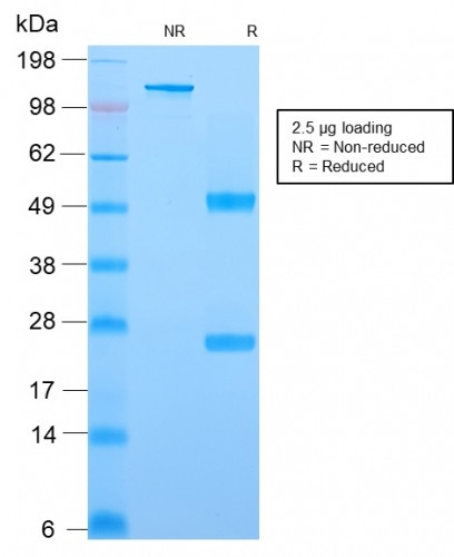 YBX1/Y-box Binding Protein 1/YB-1 (Tumor Biomarker) Antibody in SDS-PAGE (SDS-PAGE)