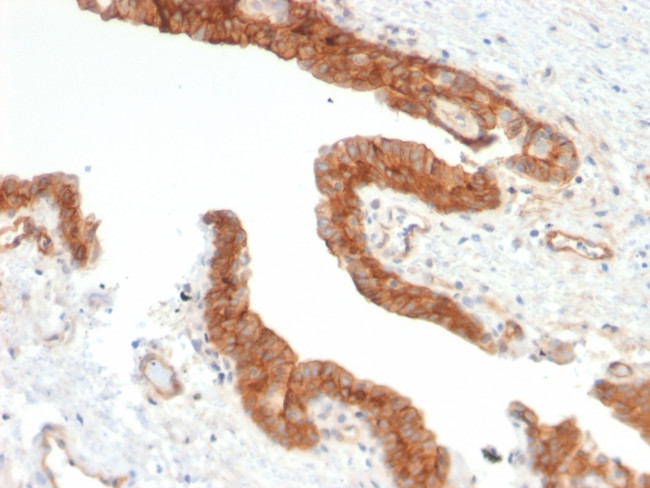 CD73 (Immuno-Oncology Target) Antibody in Immunohistochemistry (Paraffin) (IHC (P))