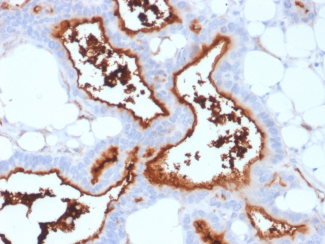 CD73 (Immuno-Oncology Target) Antibody in Immunohistochemistry (Paraffin) (IHC (P))