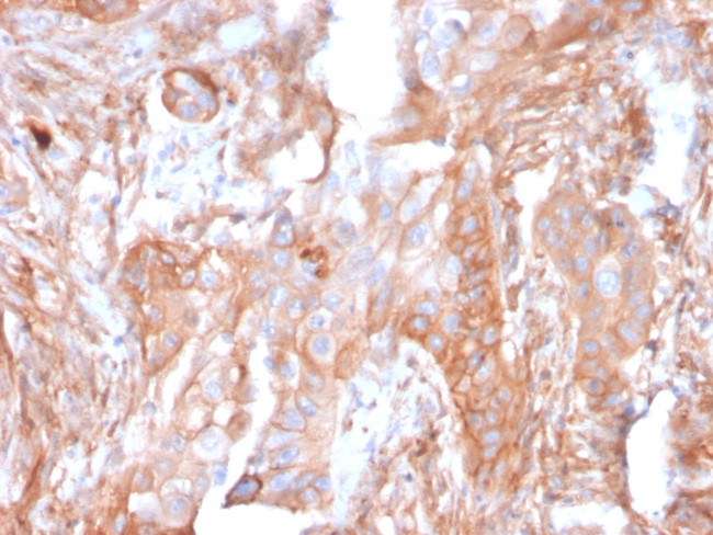 CD73 (Immuno-Oncology Target) Antibody in Immunohistochemistry (Paraffin) (IHC (P))