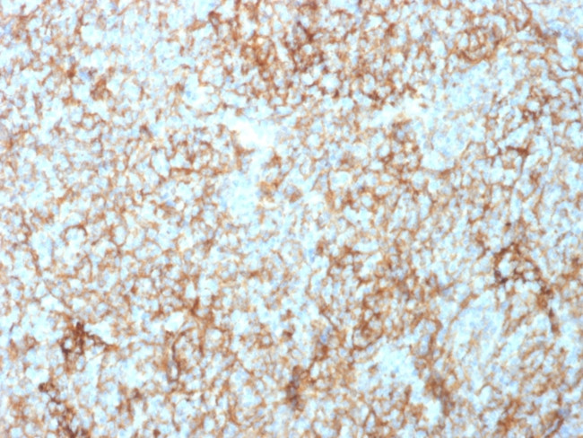 CD73 (Immuno-Oncology Target) Antibody in Immunohistochemistry (Paraffin) (IHC (P))