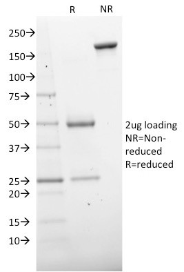 CD73 (Immuno-Oncology Target) Antibody in SDS-PAGE (SDS-PAGE)