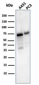 CD73 (Immuno-Oncology Target) Antibody in Western Blot (WB)