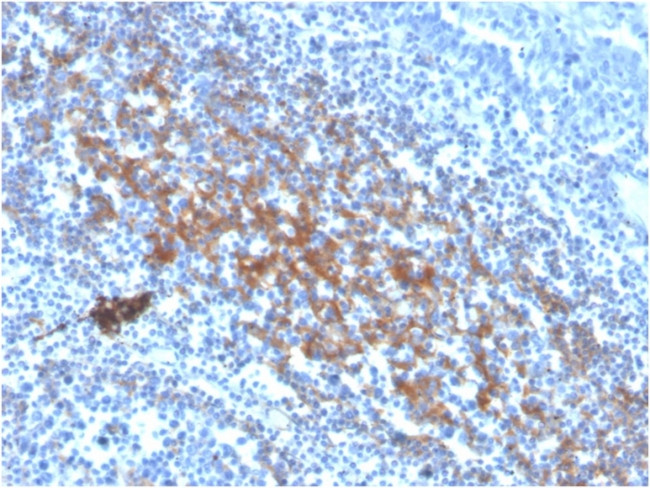 CD73 (Immuno-Oncology Target) Antibody in Immunohistochemistry (Paraffin) (IHC (P))